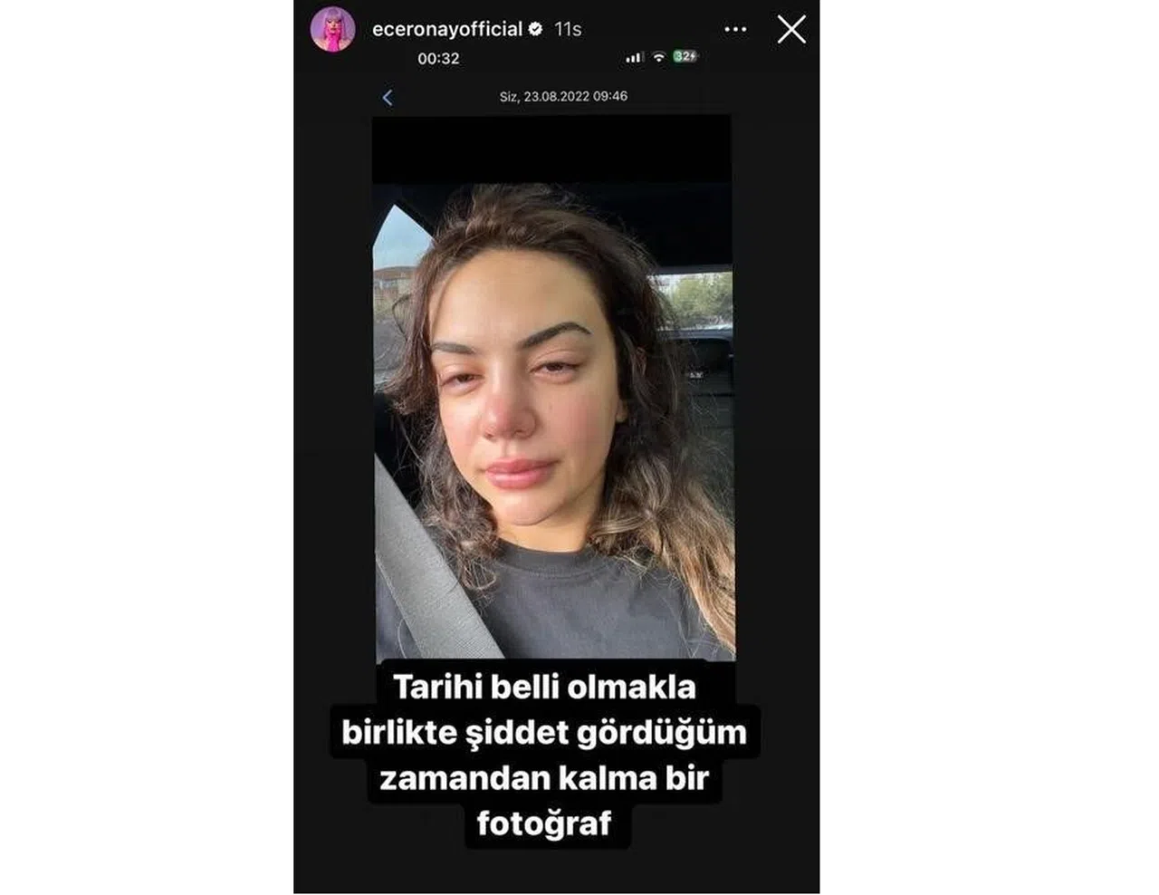 Ece Ronay’ın eski eşine tazyik hapsi verildi  