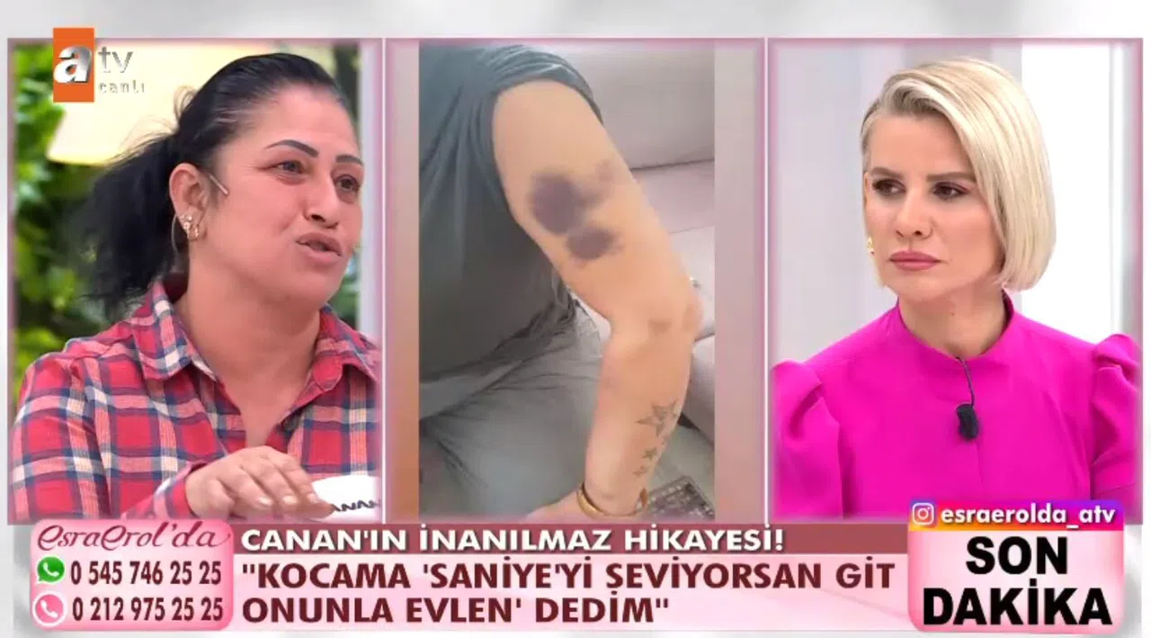 ESRA EROL’DA CANLI İZLE! Canan Pekesen kimdir, nereli, kaç yaşında?