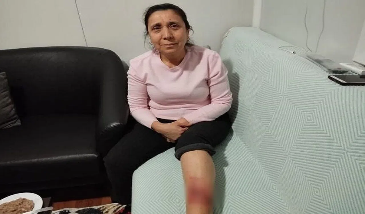 Köpek saldırısına uğrayan kadının bacağında yarık oluştu  