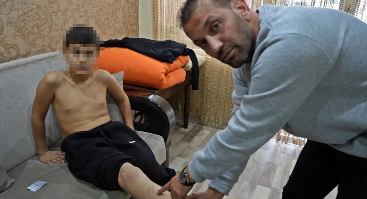 Ailesinin ‘kavga etme, şikayet gelmesin’ sözüyle akranlarının zorbalığını 2 ay boyunca sakladı