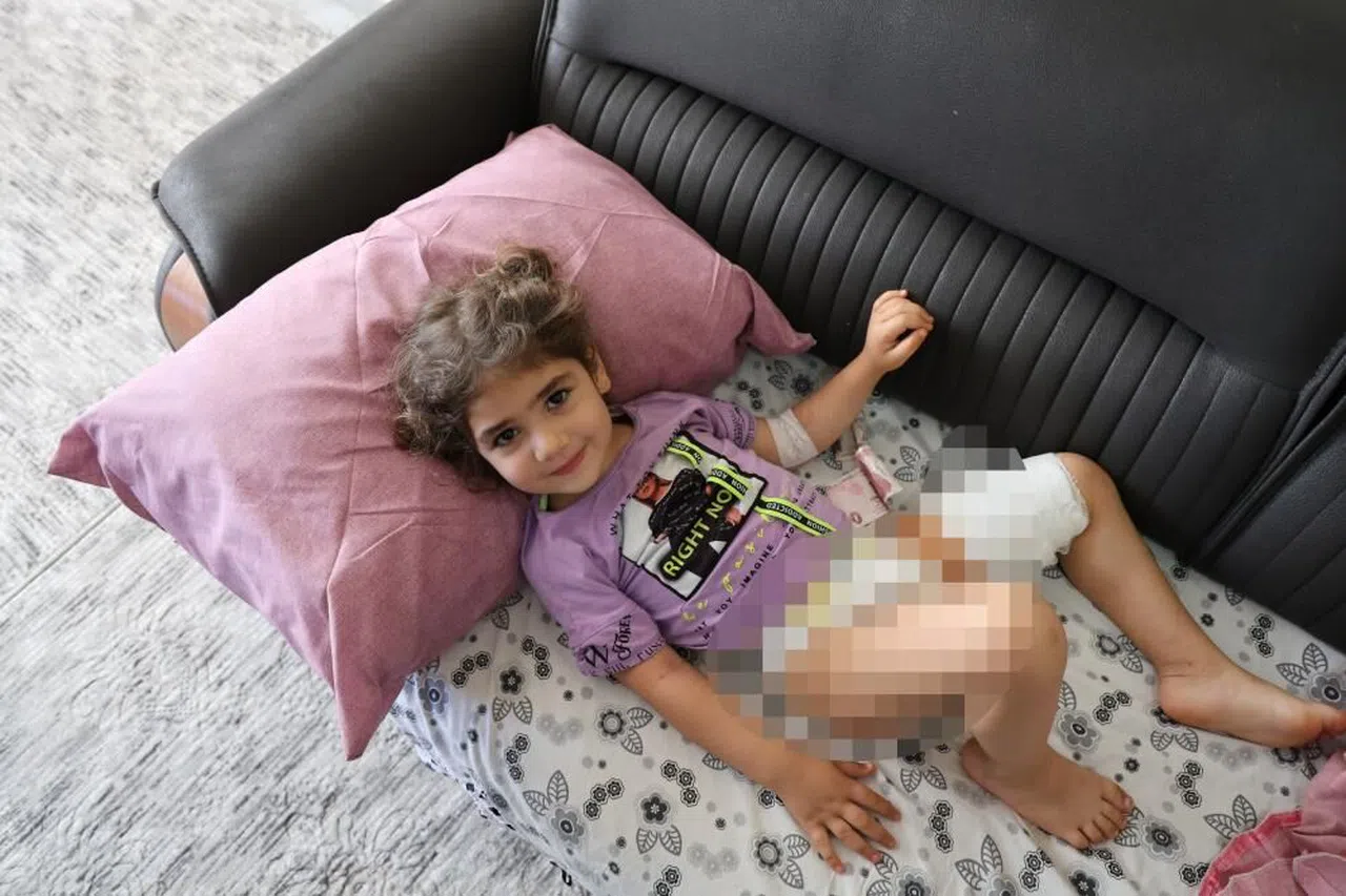 Köpeğin ısırdığı kız çocuğu o anları anlattı