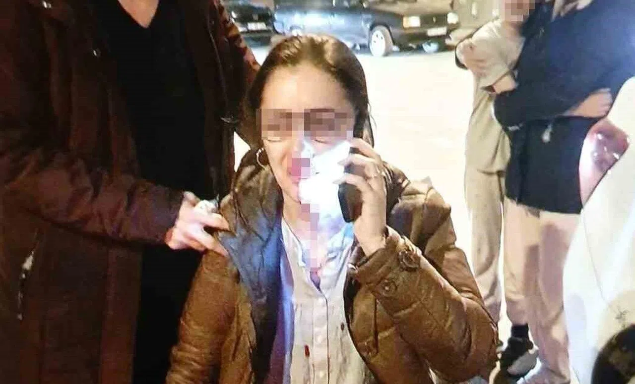 Kocasının sevgilisine benzettiği kadını darbetti, pardon deyip kaçtı