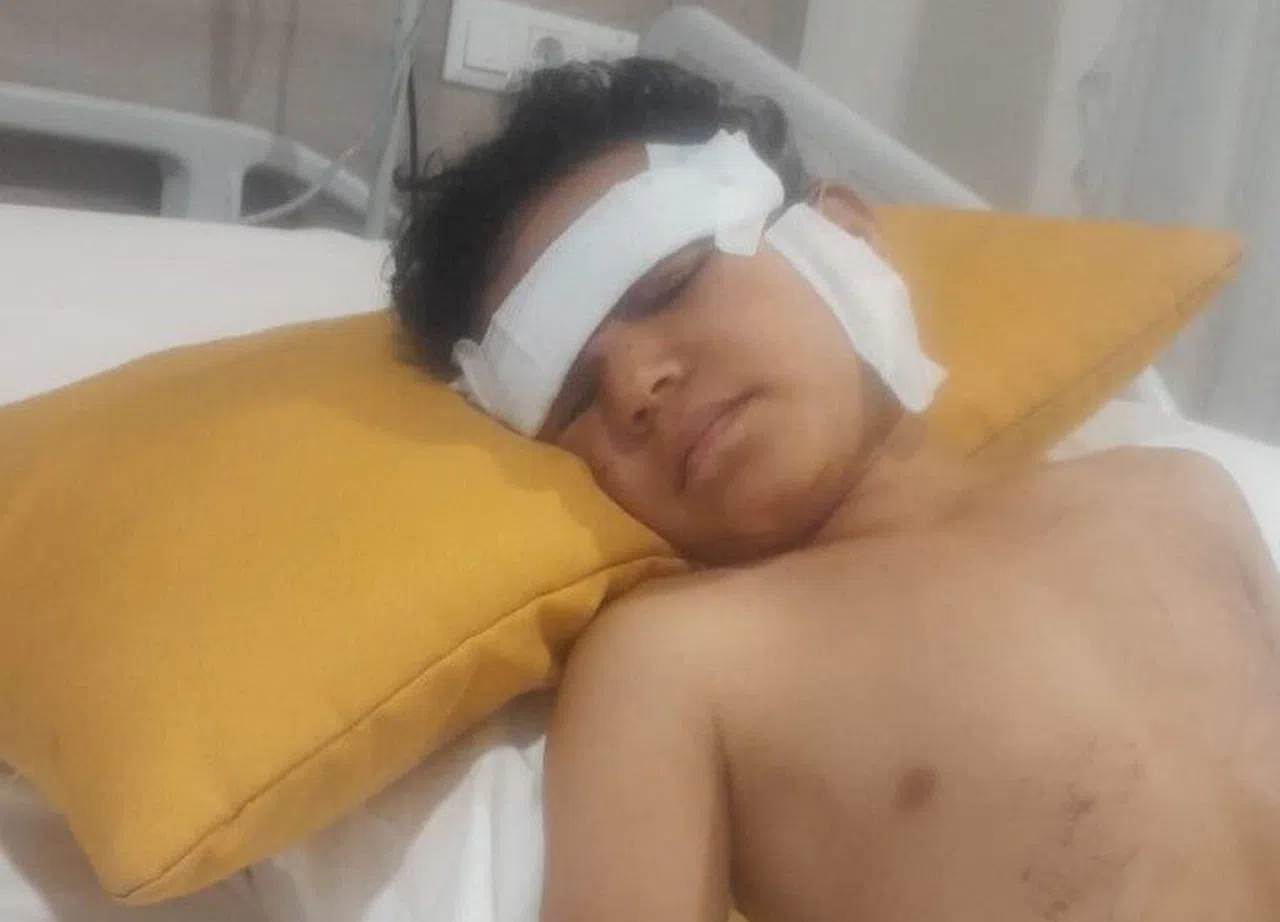 Sokak köpeği 5 yaşındaki çocuğun yüzünü parçaladı