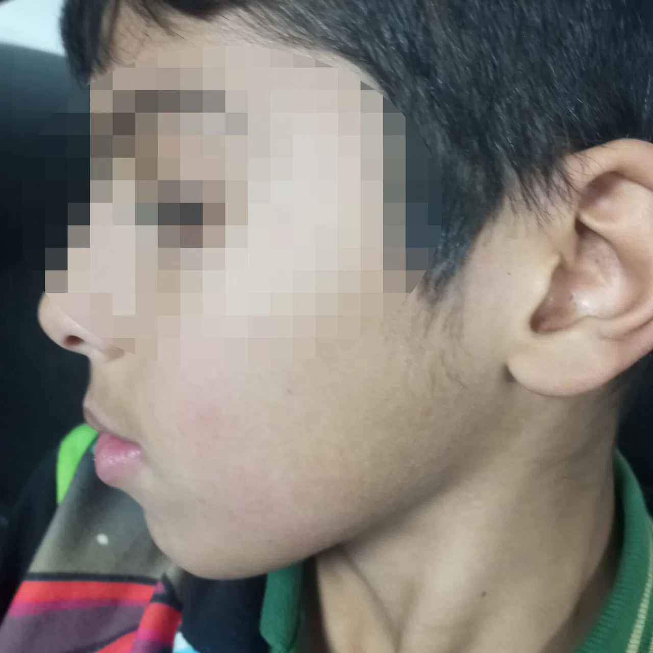 Antalya'da Öğretmeninin Darp Ettiği İleri Sürülen Çocuğun Ailesi Şikayetçi Oldu