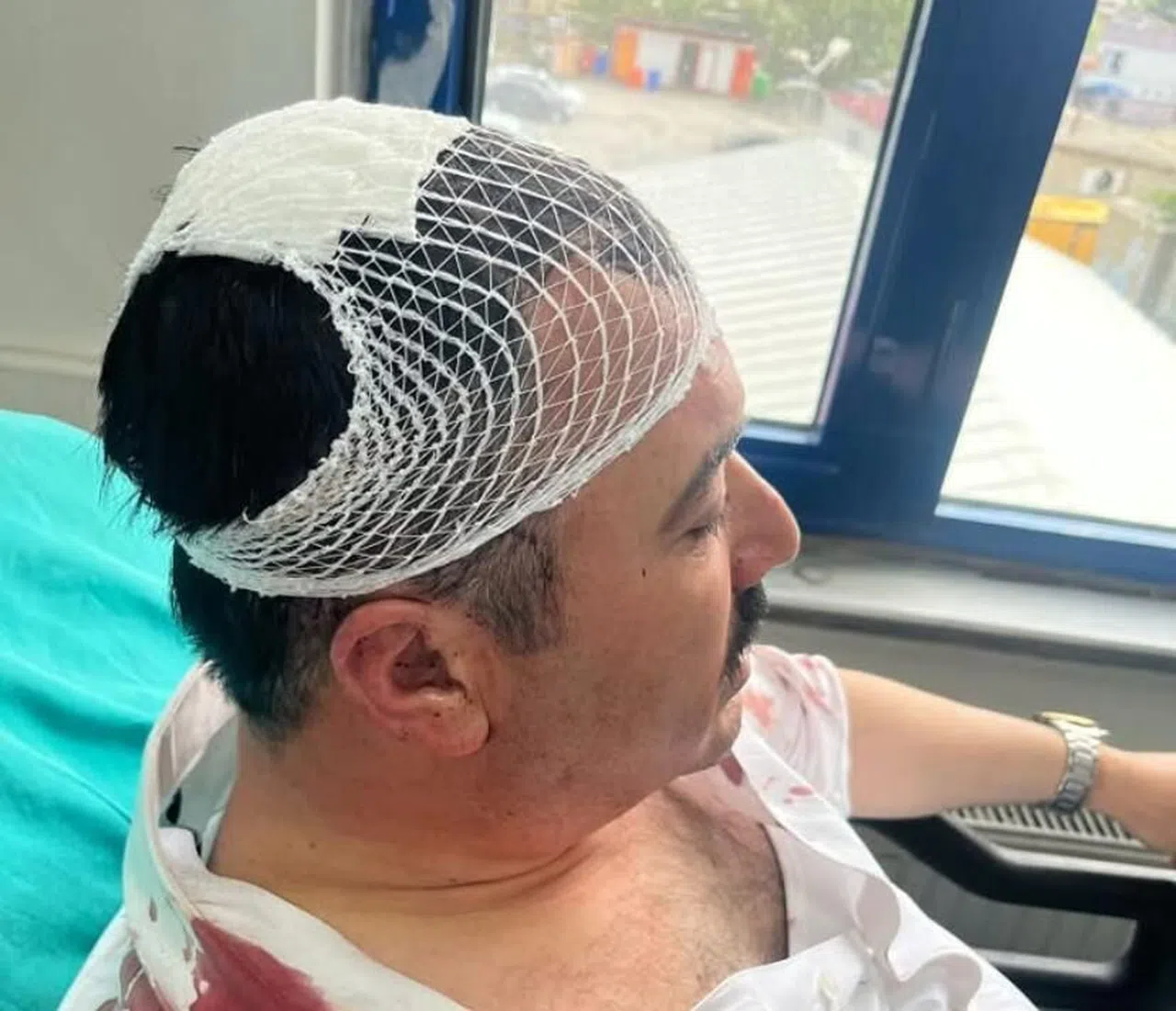 Belediye başkan yardımcısını şekerlikle yaralayan YRP'li başkan yardımcısı tutuklandı