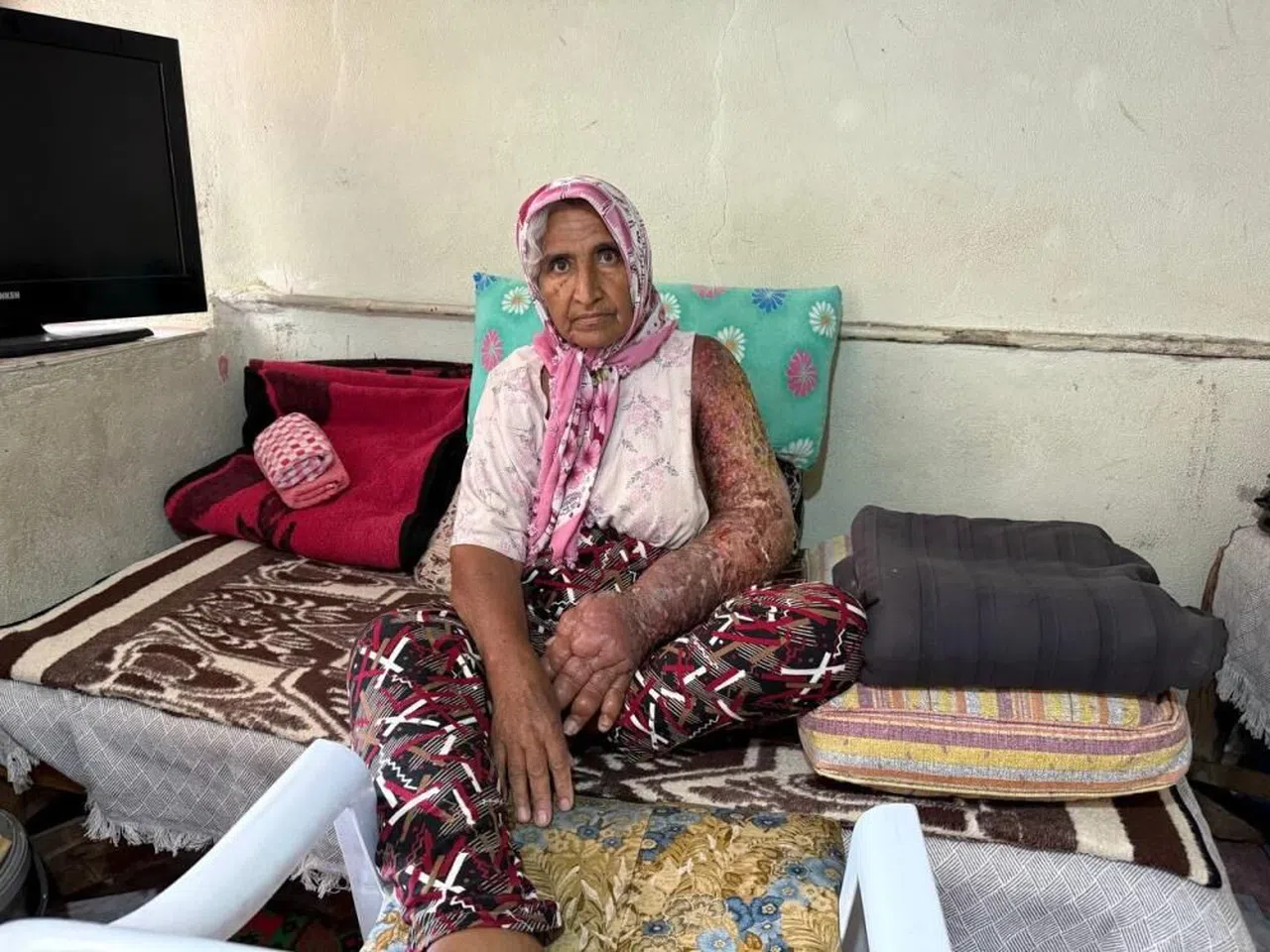 4 Çocuk Annesi Kadın Tedavi İçin Yardım Bekliyor