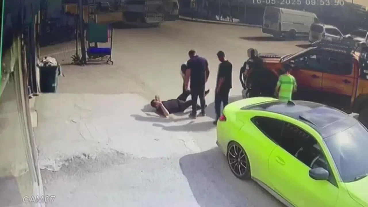 Şaka kazaya dönüştü: Kamyonetin çarpmasıyla ayağı kırıldı, telefonu bırakmadı