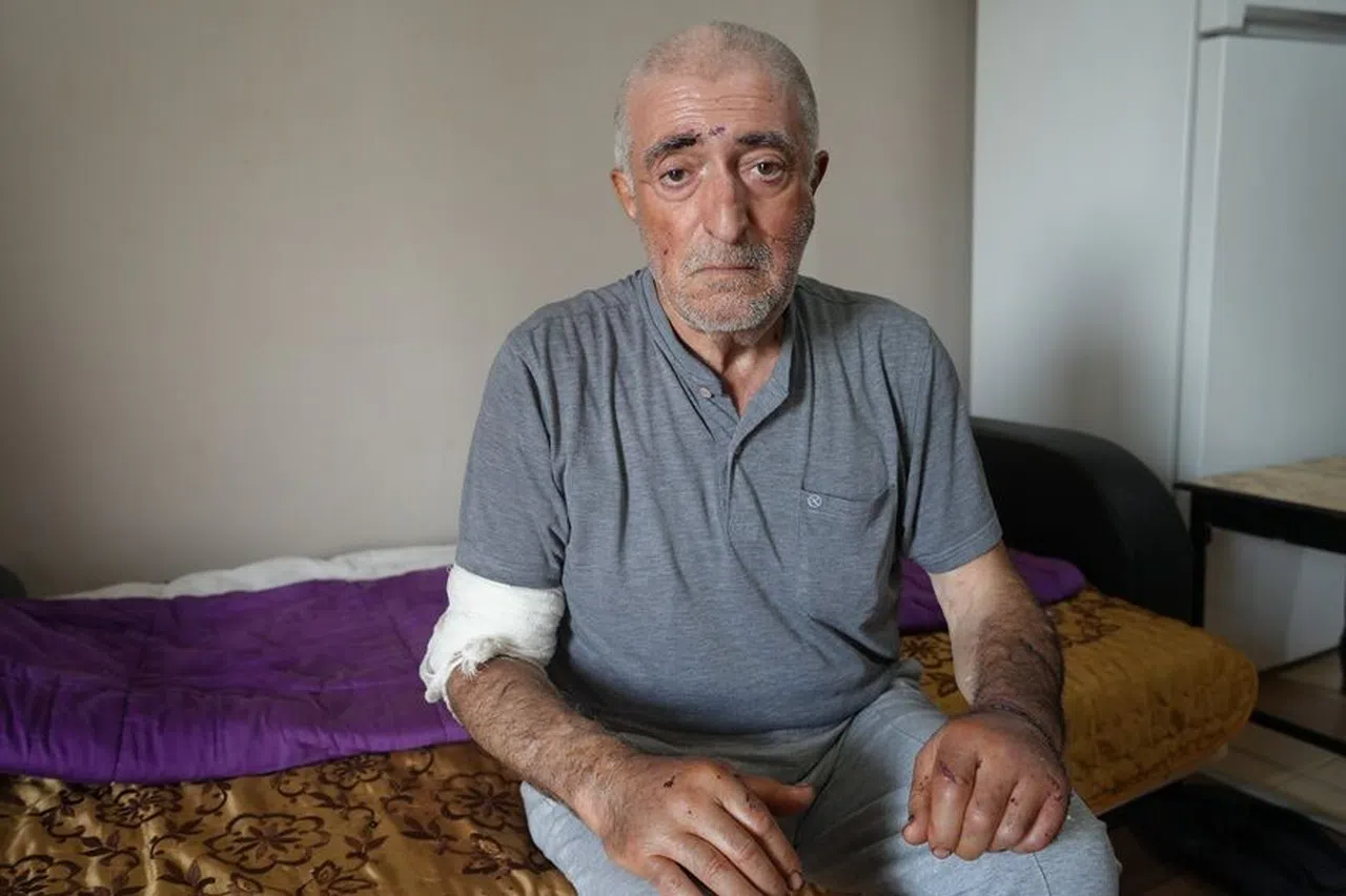 Eşi Tarafından Defalarca Bıçaklandı