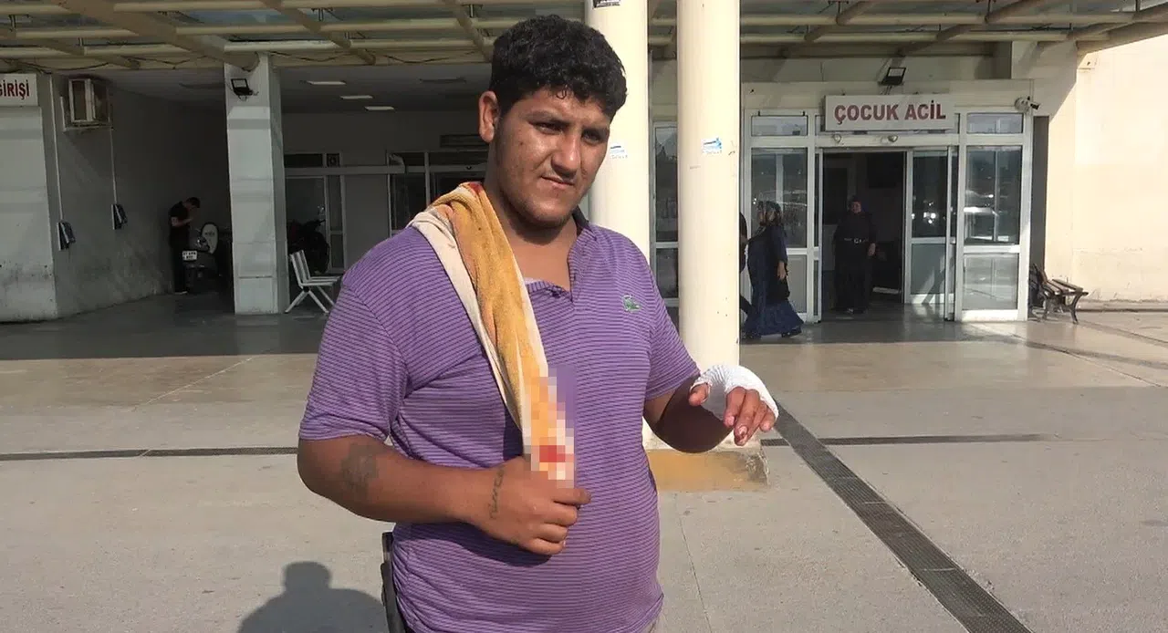 194 Acemi Kasap Hastanelik Oldu