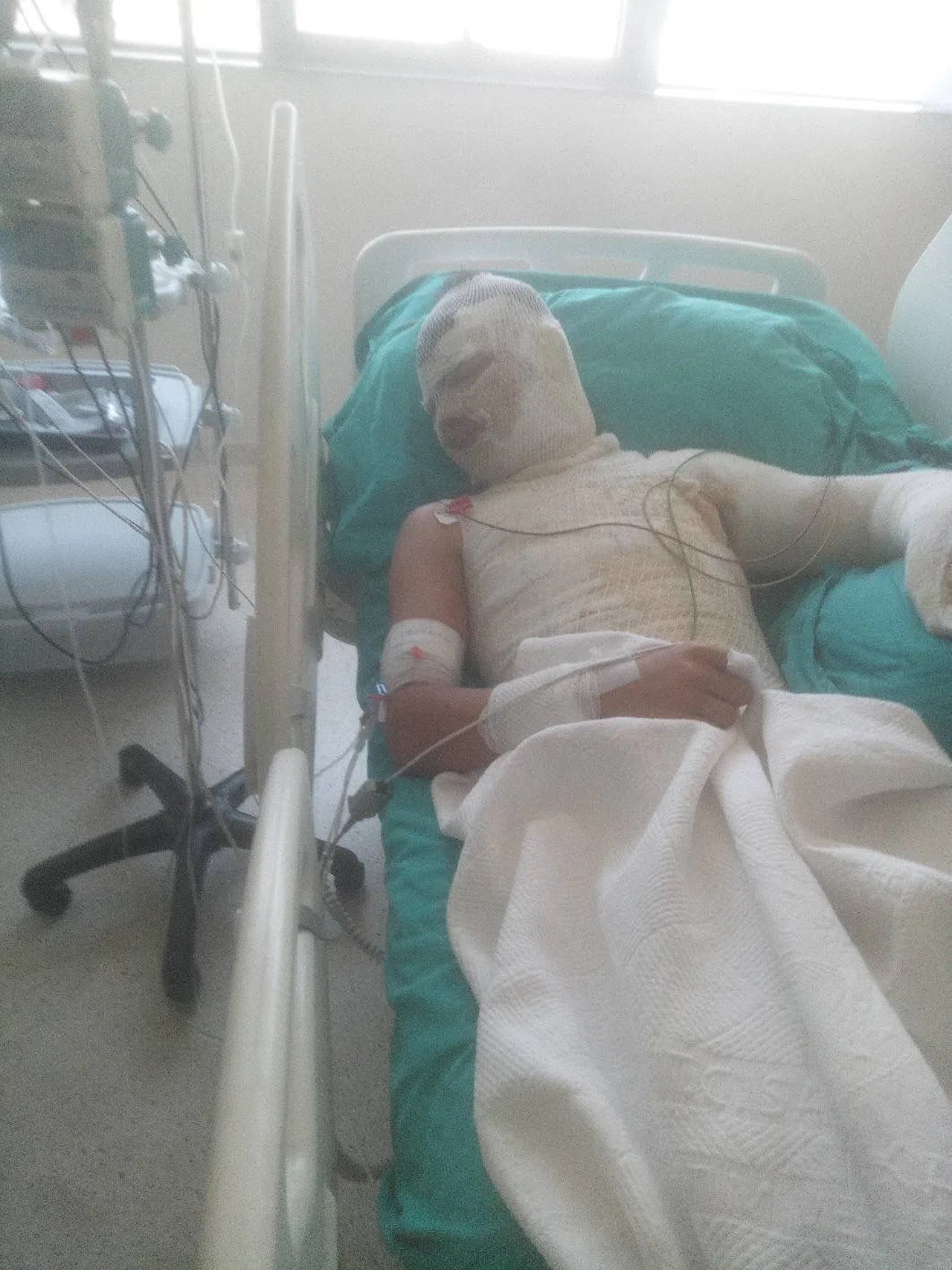 Kan Donduran Görüntüler: Amca, Yeğenini Ateşe Verdi