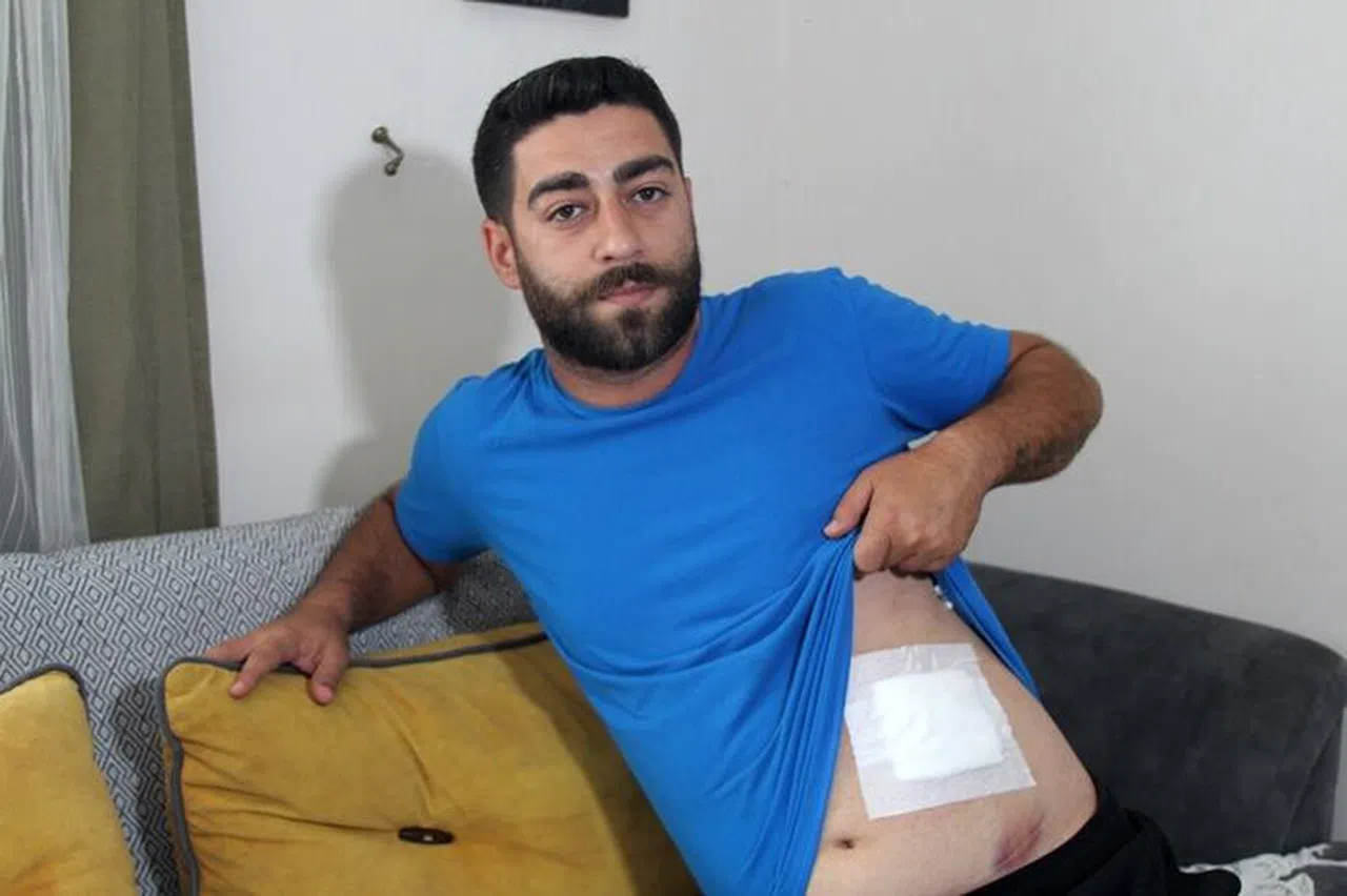 Bayramlaşmaya Gitti, Karnına Yorgun Mermi İsabet Etti