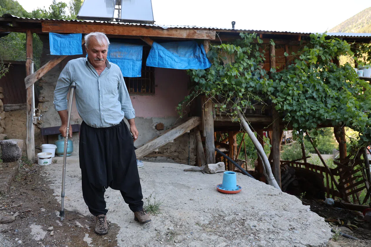 45 Yıllık Hayali 'Protez Bacağa' Kavuştu: "Gözüm Yüzde 5 Görüyor Ama Artık Ayağım Var"