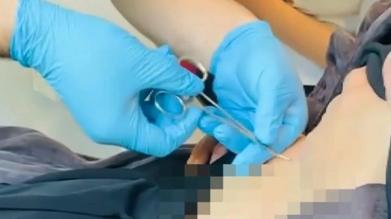 Halsizlik Şikayetiyle Gitti, Karnındaki Keneyle Şoke Oldu!