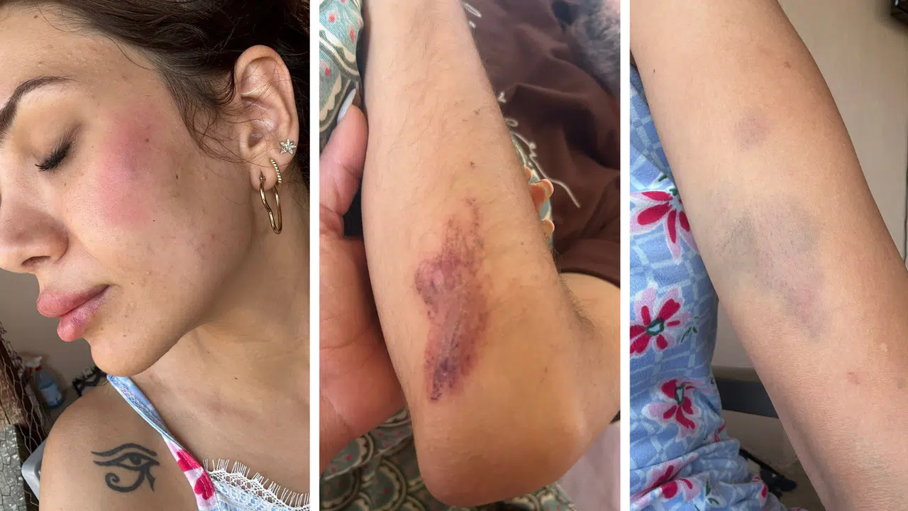 Sokak Köpeklerini Besleyen Veterinere Komşu Dayağı