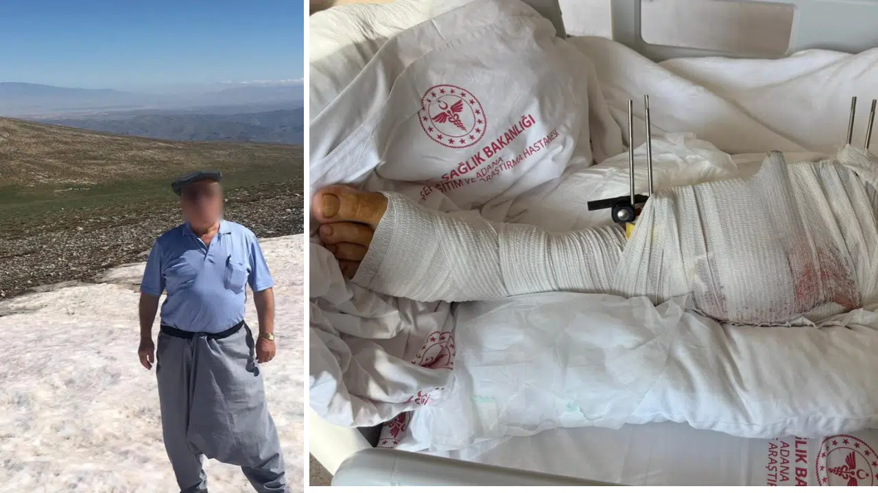 Muhtar, Eski Damadını Tartışma Sonrası Silahla Yaraladı