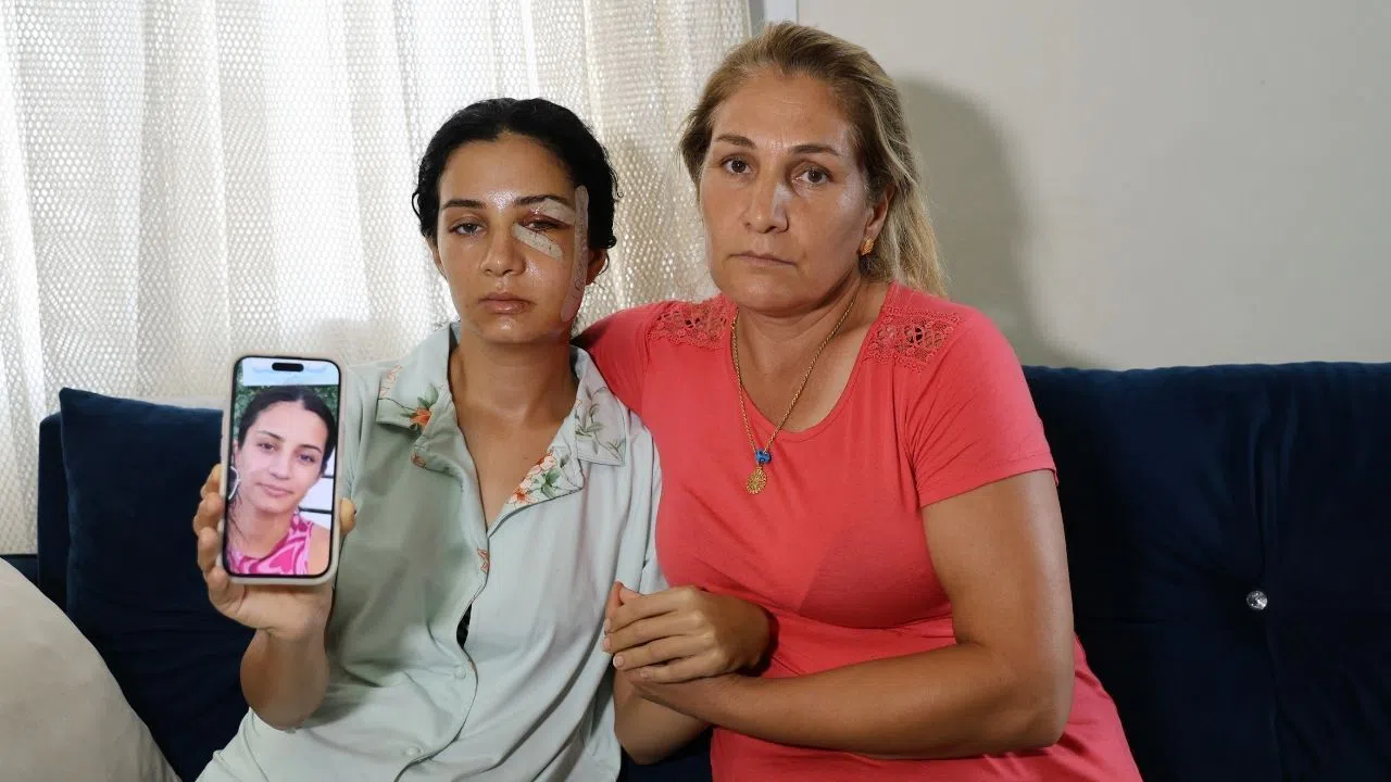 Genç Kadın Eski Eşi Tarafından Öldüresiye Dövüldü