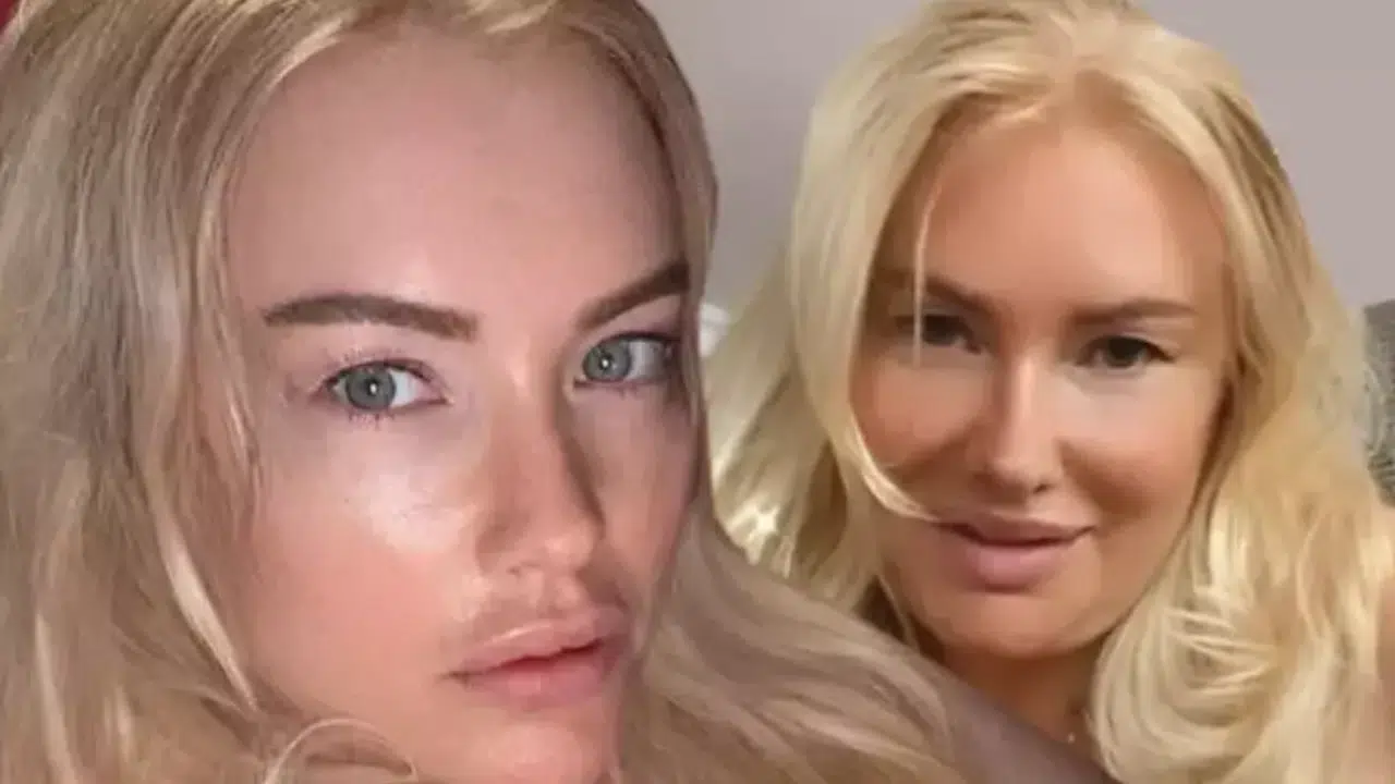 Hilal Cebeci’nin Son Hali Sosyal Medyayı Salladı