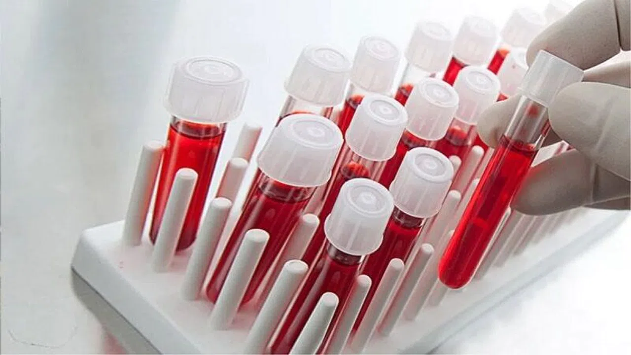 Bu kan gruplarına çok kötü haber: Bir anda başlarına gelebilir