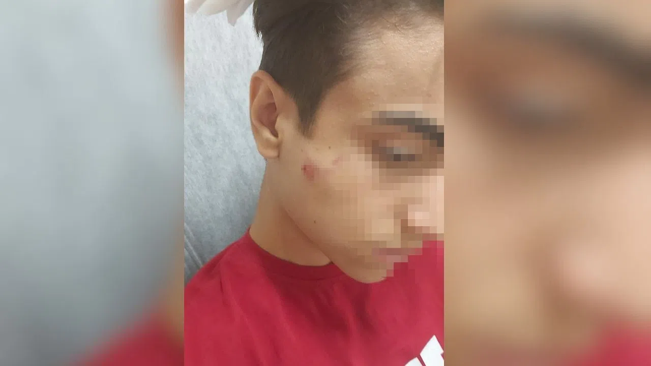 Öğrenci Okul Çıkışında Akranı Tarafından Darbedildi