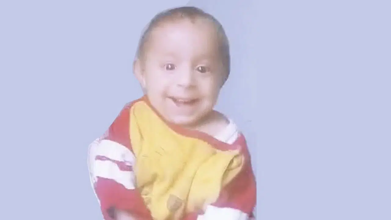 “Gülen Bebek”ten Kahreden Haber Artık Aramızda Değil