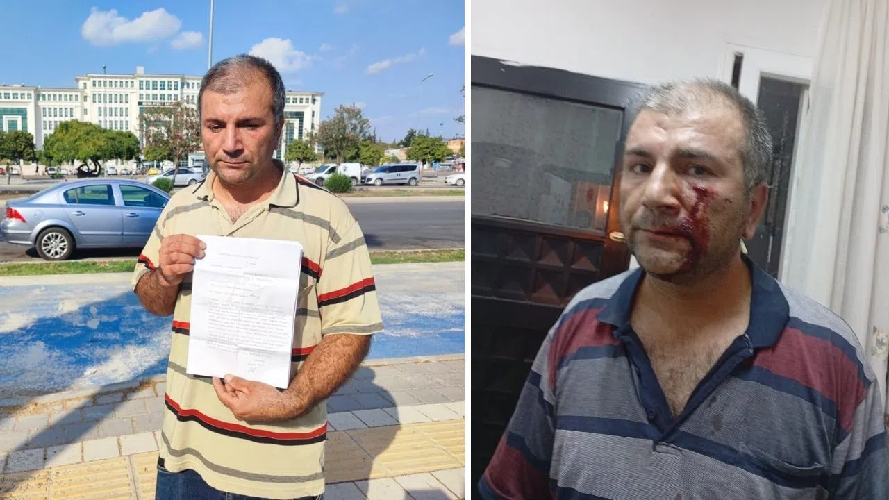 Yol Uyarısı Tartışmaya Dönüştü, Vatandaş Darbedildi