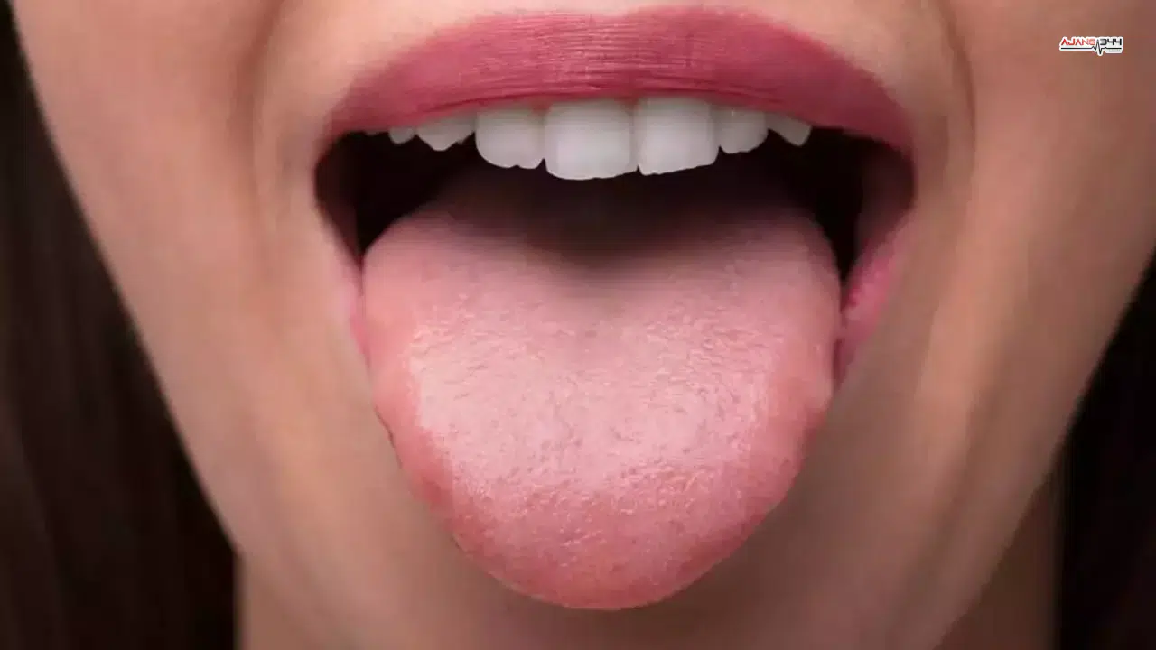 Dilinize Dikkat Edin Hastalık Belirtisi Olabilir