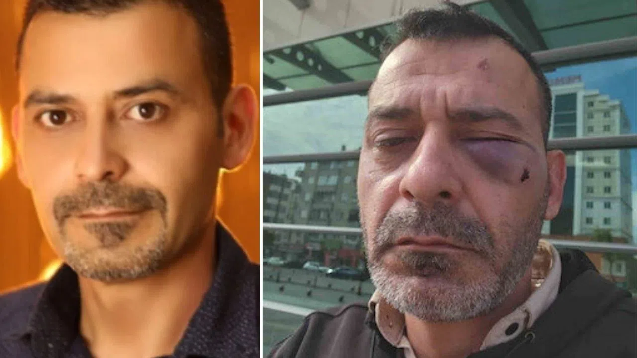 Kukla Sanatçısı Adem Ocaktan'ı Öldüresiye Darp Ettiler!