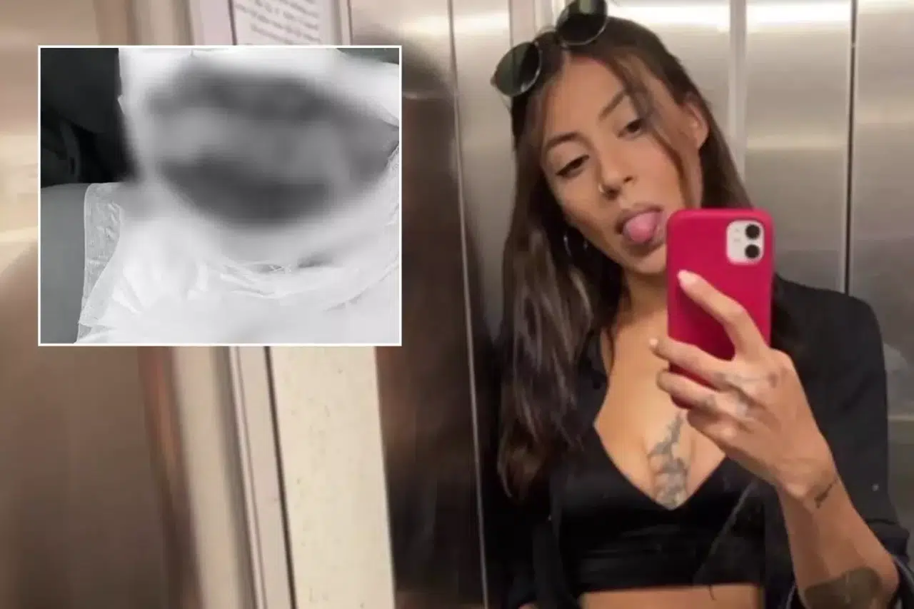 Lüks Semtte Korkunç Saldırı! Genç Kadın Alevler İçinde Kaldı