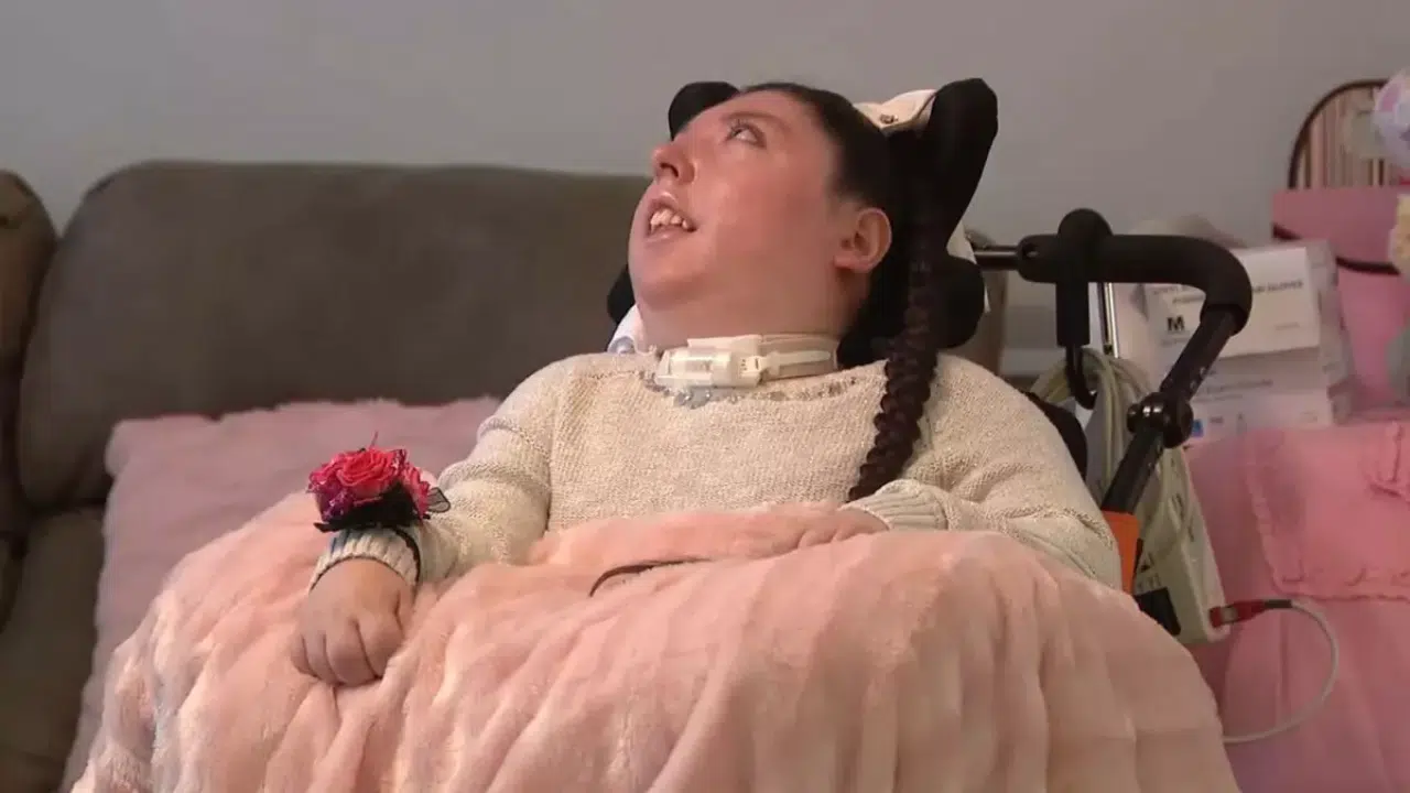 Beyinsiz Doğdu Doktorlar 5 Yıl Yaşamaz Demişti 20. Yaşını Kutluyor