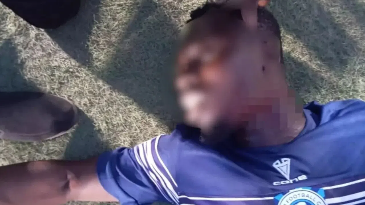 Ülke Şokta Taraftar Futbolcunun Boğazını Kesti