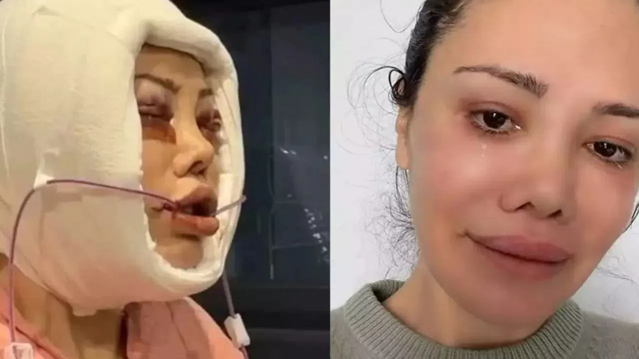 Yüz nakli olan ünlü isimden acı haber geldi!