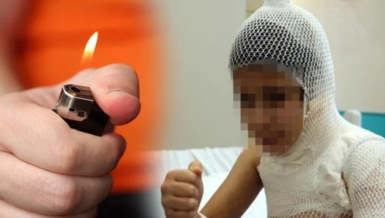 Trendlerin Riski: Kolonya Yakma Modası Çocukları Alev Alev Tehdit Ediyor