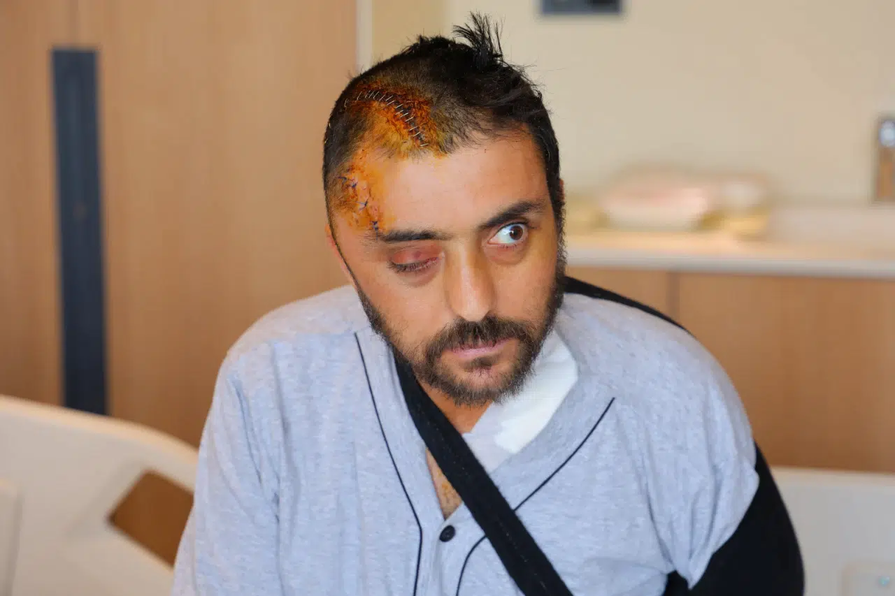 Kahramanmaraş’ta Aracına Kaya İsabet Eden Sürücü Ameliyatla Sağlığına Kavuştu