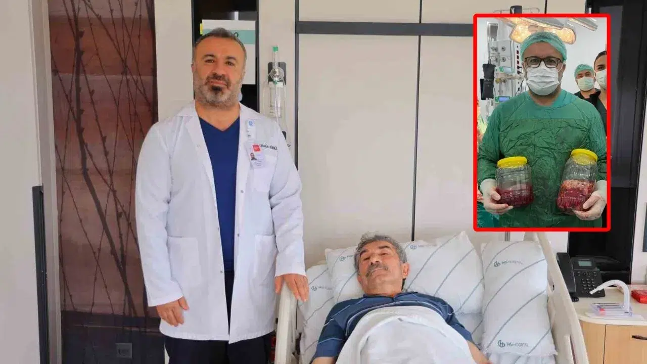 Kahramanmaraş’ta 20 cm böbrek tümörü alındı