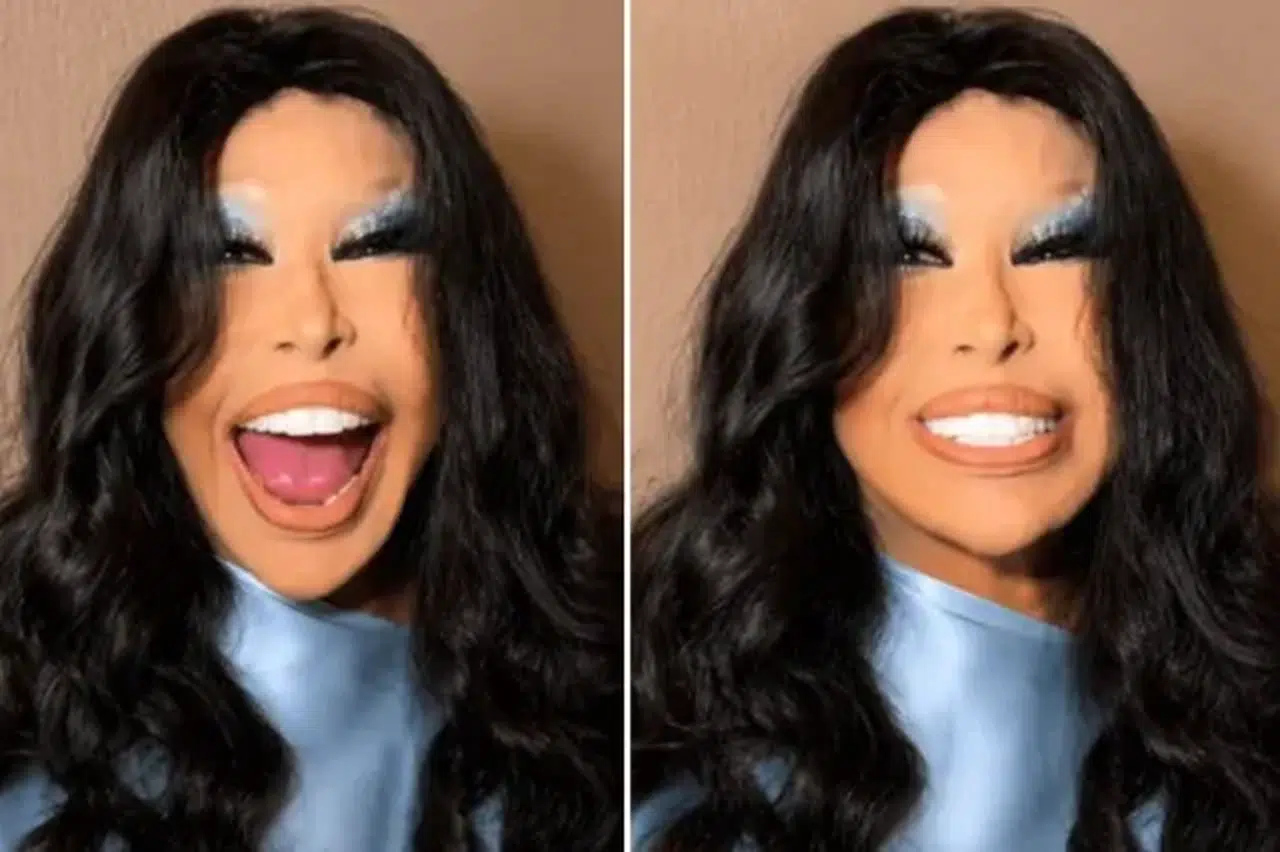 Bülent Ersoy Estetik Sonrası İlk Kez Sahneye Çıktı
