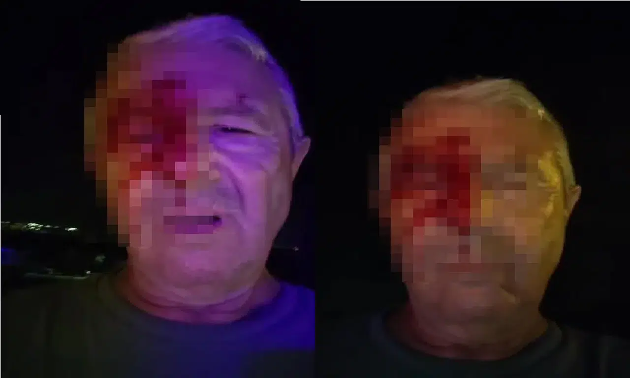 Görevi Başındaki Muhabire Yumruklu Saldırı