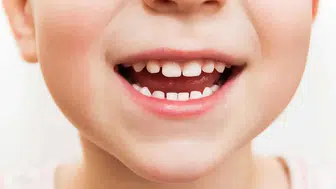 Uzmanlar Uyardı Çocuklarınızın Diş Sağlığı İçin Bunlar Şart!