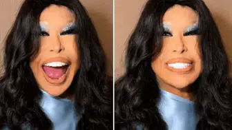 Bülent Ersoy Estetik Sonrası İlk Kez Sahneye Çıktı
