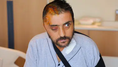 Kahramanmaraş’ta Aracına Kaya İsabet Eden Sürücü Ameliyatla Sağlığına Kavuştu