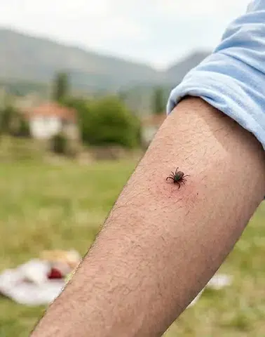 Kahramanmaraş’ta Keneye Karşı Kritik Uyarı