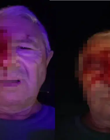 Görevi Başındaki Muhabire Yumruklu Saldırı