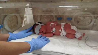 Terkedilen bebeğe hemşireler annelik yapıyor