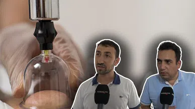 Hacamatın faydaları saymakla bitmiyor