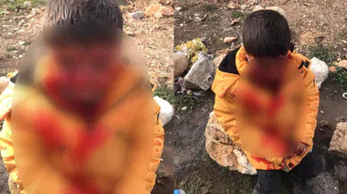 Başıboş Köpeklerin Saldırdığı Çocuk Ağır Yaralandı