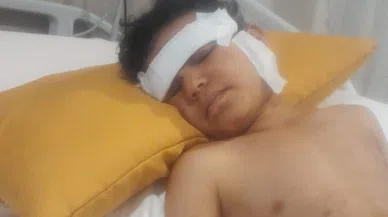 Sokak köpeği 5 yaşındaki çocuğun yüzünü parçaladı