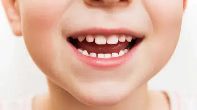 Uzmanlar Uyardı Çocuklarınızın Diş Sağlığı İçin Bunlar Şart!