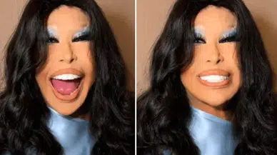 Bülent Ersoy Estetik Sonrası İlk Kez Sahneye Çıktı