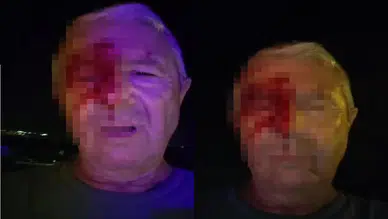 Görevi Başındaki Muhabire Yumruklu Saldırı