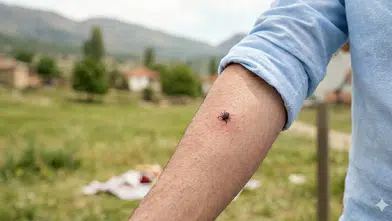 Kahramanmaraş’ta Keneye Karşı Kritik Uyarı