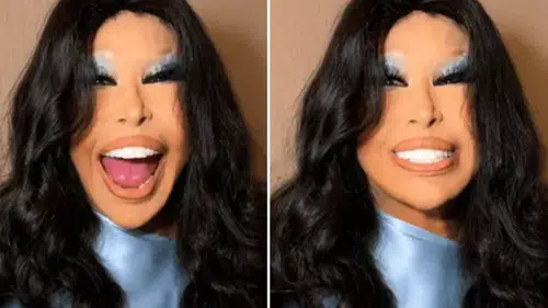 Bülent Ersoy Estetik Sonrası İlk Kez Sahneye Çıktı